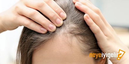 Saç Dökülmesine Ne İyi Gelir? | neyeiyigelir.com.tr